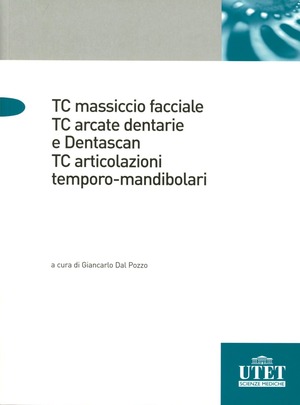 TC massiccio facciale. TC arcate dentali e Dentascan