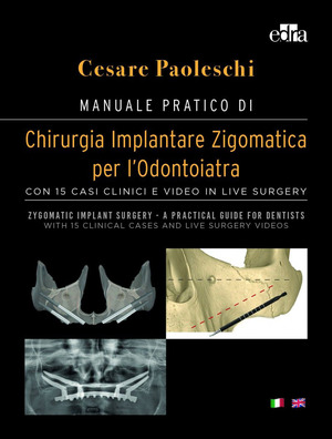Manuale pratico di chirurgia implantare zigomatica per l’odontoiatra. Con 15 casi clinici e video in live surgery-Zygomatic implant surgery. A practical guide for dentist. With 15 clinical cases and live surgery videos. Ediz. a colori. Con DVD video