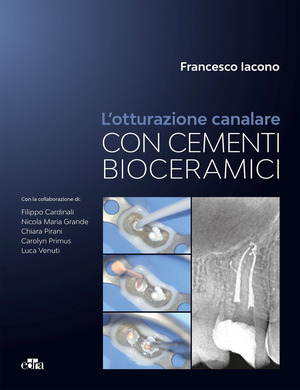 L' otturazione canalare con cementi bioceramici