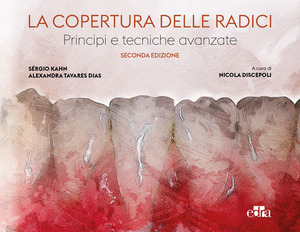 La copertura delle radici. Principi e tecniche avanzate. Con QR Code