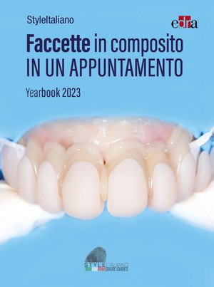 Faccette in composito in un appuntamento. Yearbook 2023