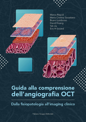 Guida alla comprensione dell’angiografia OCT. Dalla fisiopatologia all'imaging clinico