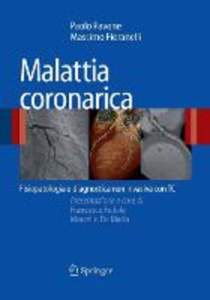 Malattia coronarica. Fisiopatologia e diagnostica non ivasiva con TC