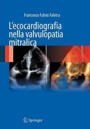 L' ecocardiografia nella valvulopatia mitralica