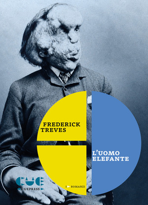 L' uomo elefante
