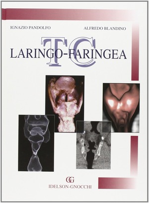 TC laringo-faringea