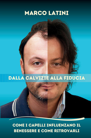 Dalla calvizie alla fiducia. Come i capelli influenzano il benessere e come ritrovarli